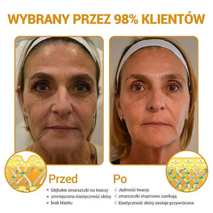 ✨Furzero™ Zaawansowany krem przeciwzmarszczkowy do ujędrniania skóry:✨ Regeneruje komórki skóry, przywracając jej elastyczność🔥