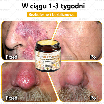 🎅APKAPK™ Skuteczny krem do kompleksowej pielęgnacji skóry, 🧑‍⚕️🧑‍⚕️🧑‍⚕️zatwierdzony przez Polskie Towarzystwo Dermatologiczne (PTD) oraz  – Państwowy Zakład Higieny (PZH).