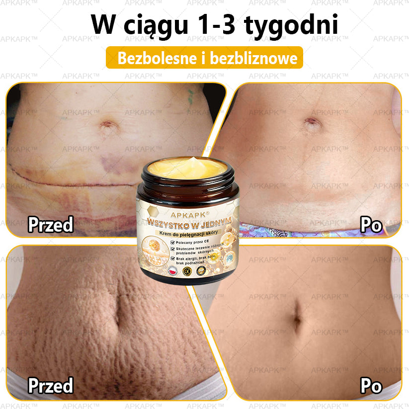 🎅APKAPK™ Skuteczny krem do kompleksowej pielęgnacji skóry, 🧑‍⚕️🧑‍⚕️🧑‍⚕️zatwierdzony przez Polskie Towarzystwo Dermatologiczne (PTD) oraz  – Państwowy Zakład Higieny (PZH).