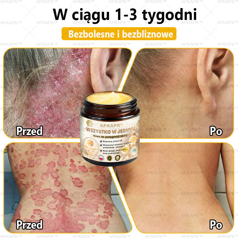 🎅APKAPK™ Skuteczny krem do kompleksowej pielęgnacji skóry, 🧑‍⚕️🧑‍⚕️🧑‍⚕️zatwierdzony przez Polskie Towarzystwo Dermatologiczne (PTD) oraz  – Państwowy Zakład Higieny (PZH).
