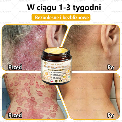 🎅APKAPK™ Skuteczny krem do kompleksowej pielęgnacji skóry, 🧑‍⚕️🧑‍⚕️🧑‍⚕️zatwierdzony przez Polskie Towarzystwo Dermatologiczne (PTD) oraz  – Państwowy Zakład Higieny (PZH).