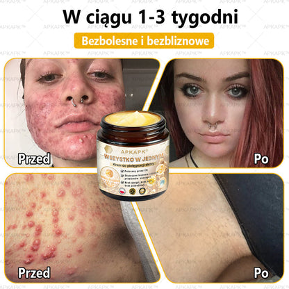 🎅APKAPK™ Skuteczny krem do kompleksowej pielęgnacji skóry, 🧑‍⚕️🧑‍⚕️🧑‍⚕️zatwierdzony przez Polskie Towarzystwo Dermatologiczne (PTD) oraz  – Państwowy Zakład Higieny (PZH).