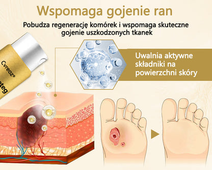 Cvreoz® Leczniczy spray do stóp cukrzycowych- zawiera jad pszczeli, który przyspiesza gojenie i zapobiega infekcjom!🌿